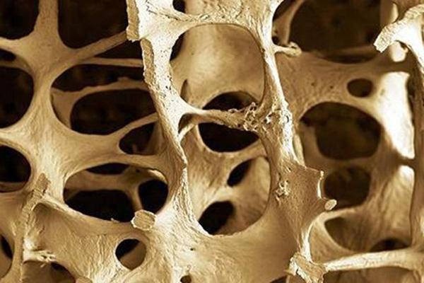 osteoporoza i sastav kostiju - zona komfora blog