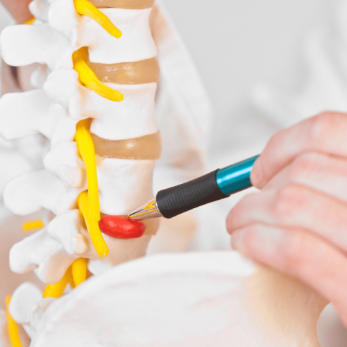 Bol u vratu – Šta je cervikalni sindrom i kako da se rešite diskus hernije vrata?